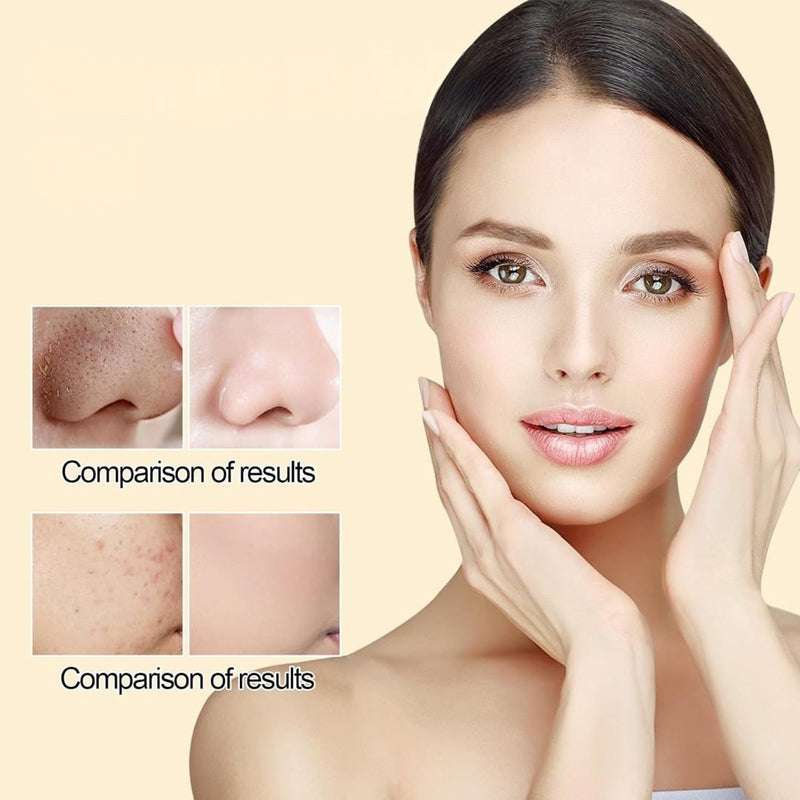 GlowEnzyme™ Exfoliating Brightening Gel